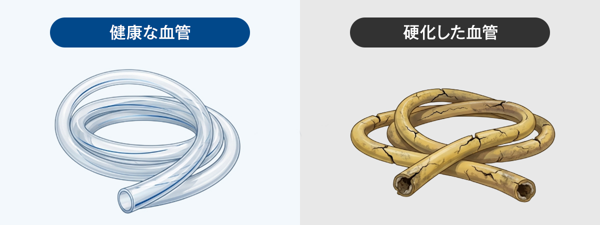 血管の違い