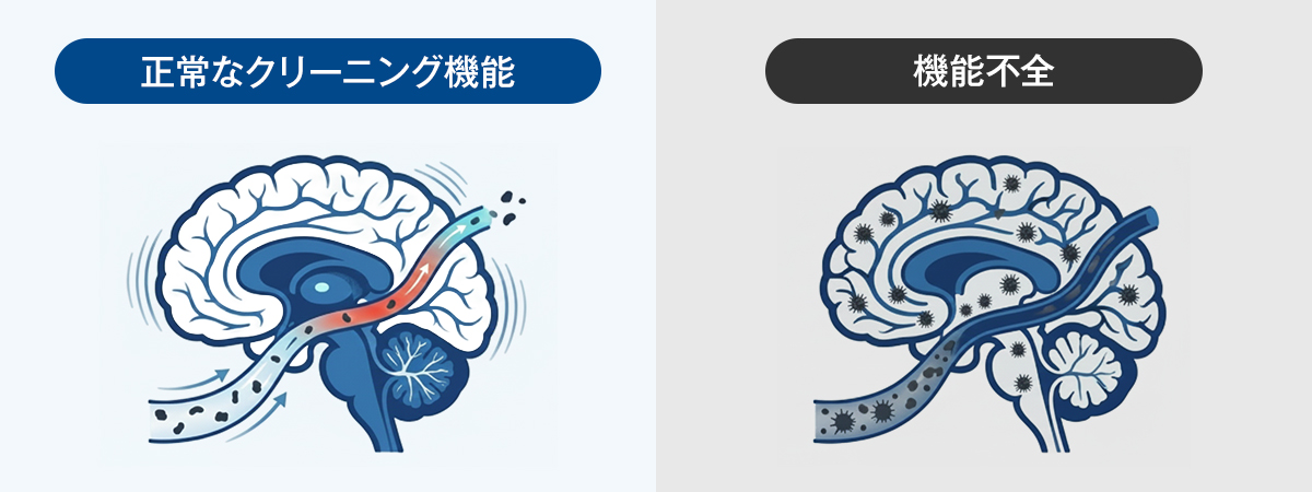 脳機能の見取り図
